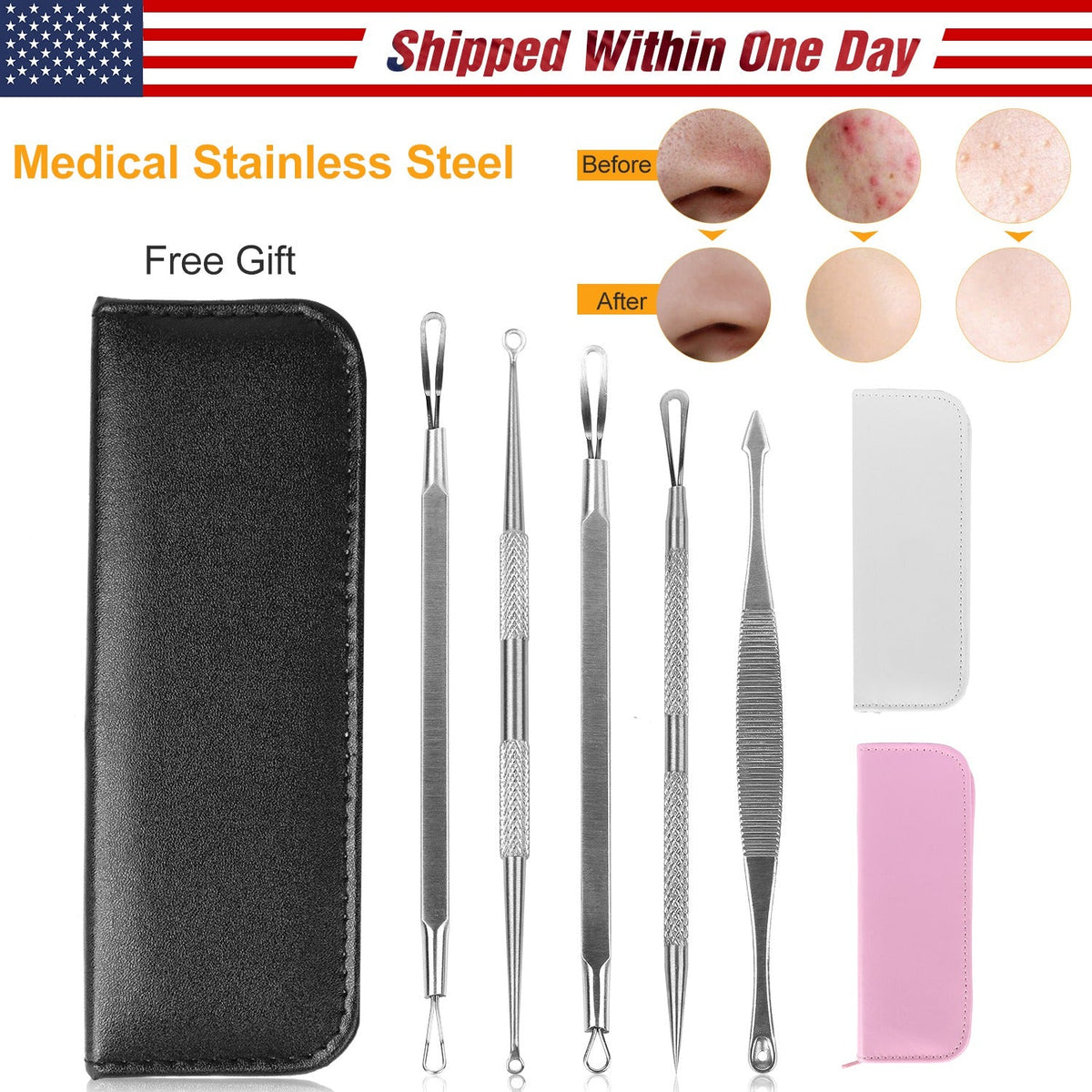 Blackhead Remover Kit – 5-Piece Stainless Steel Acne Tool Set
