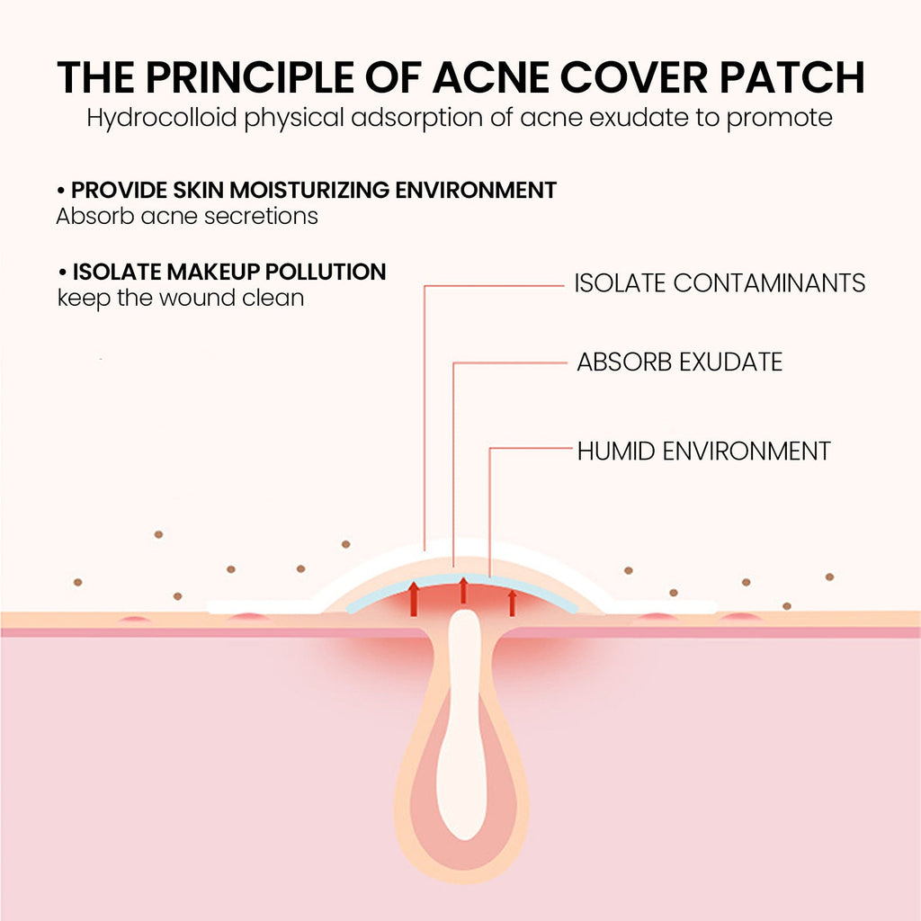 Acne Spot Patches – Lightening & Blemish Covering