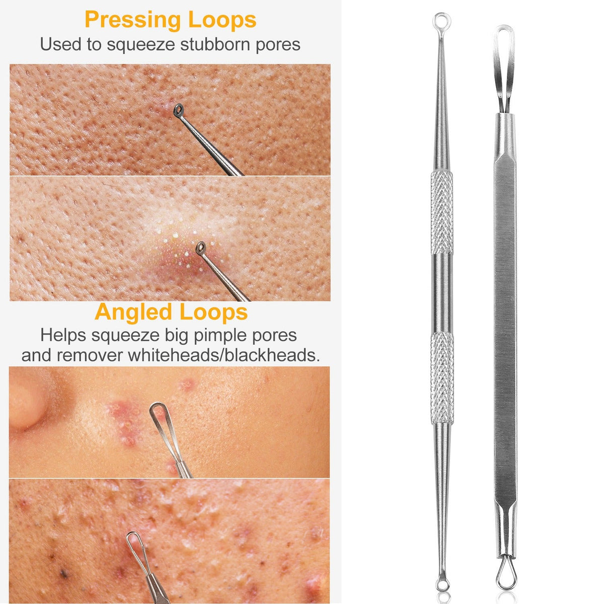 Blackhead Remover Kit – 5-Piece Stainless Steel Acne Tool Set