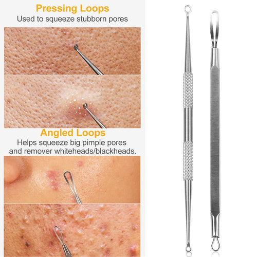 Blackhead Remover Kit – 5-Piece Stainless Steel Acne Tool Set