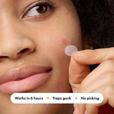 Hero Cosmetics Mighty Patch – Acne Pimple Patches 26ct