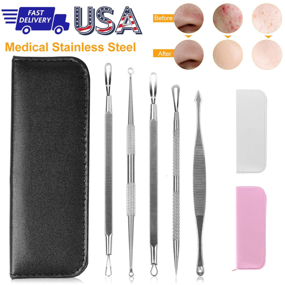 Blackhead Remover Kit – 5-Piece Stainless Steel Acne Tool Set